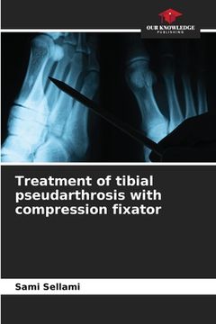 portada Treatment of tibial pseudarthrosis with compression fixator (en Inglés)