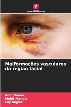 portada Malformações Vasculares da Região Facial (in Portuguese)