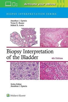 portada Biopsy Interpretation of the Bladder (Biopsy Interpretation Series) (in English)