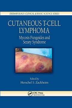 portada Cutaneous T-Cell Lymphoma: Mycosis Fungoides and Sezary Syndrome (Dermatology: Clinical & Basic Science) (in English)
