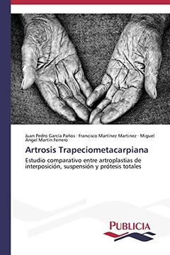 portada Artrosis Trapeciometacarpiana