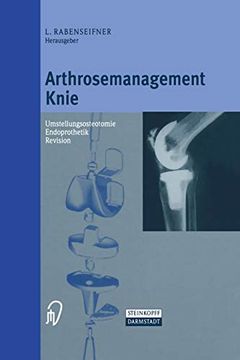 portada Arthrosemanagement Knie: Umstellungsosteotomie ― Endoprothetik ― Revision (en Alemán)