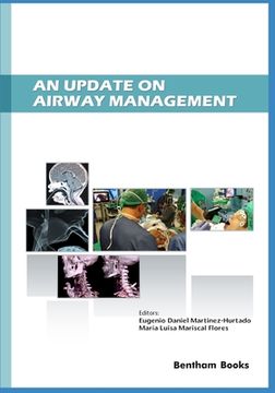 portada An Update on Airway Management (in English)