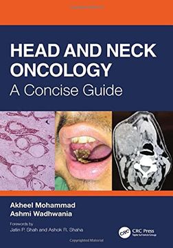 portada Head and Neck Oncology: A Concise Guide (in English)