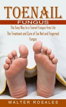 portada Toenail Fungus: The Easy way to a Toenail Fungus-Free Life (The Treatment and Cure of toe Nail and Fingernail Fungus) (in English)