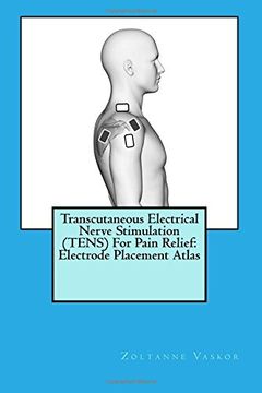 portada Transcutaneous Electrical Nerve Stimulation (TENS) For Pain Relief: Electrode Placement Atlas