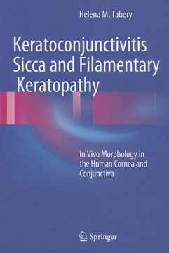 portada keratoconjunctivitis sicca and filamentary keratopathy (en Inglés)