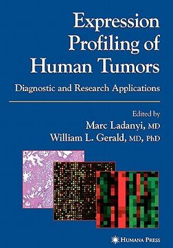 portada Expression Profiling of Human Tumors: Diagnostic and Research Applications (in English)