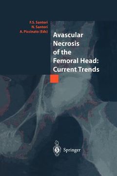 portada avascular necrosis of the femoral head: current trends: current trends (en Inglés)
