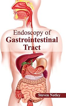 portada Endoscopy of Gastrointestinal Tract (en Inglés)