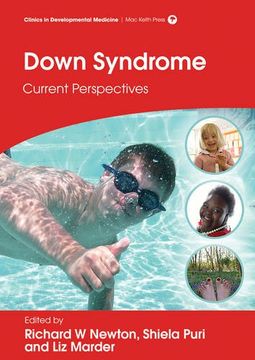 portada Down Syndrome: Current Perspectives (en Inglés)