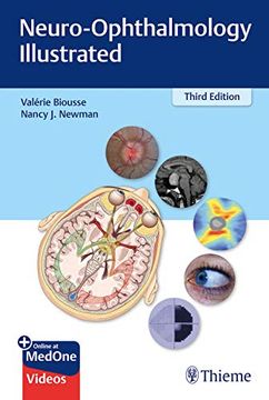 portada Neuro-Ophthalmology Illustrated (en Inglés)