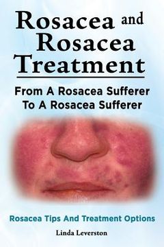 portada Rosacea and Rosacea Treatment. From a Rosacea Sufferer to a Rosacea Sufferer. Rosacea Tips and Treatment Options (en Inglés)