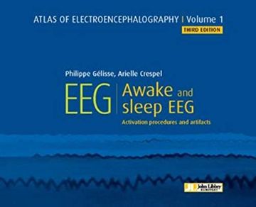 portada Atlas of Electroencephalography. Awake and Sleep Eeg. Activation Procedures and Artifacts (en Inglés)