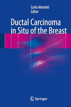 portada Ductal Carcinoma in Situ of the Breast (in English)