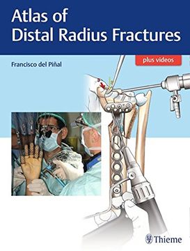 portada Atlas of Distal Radius Fractures (en Inglés)