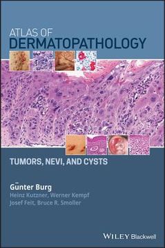 Atlas of Dermatopathology: Tumors, Nevi, and Cysts (en Inglés)