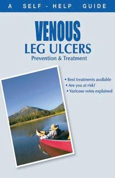 portada The Doctor's Guide to: Venous Leg Ulcers: Prevention and Treatment (in English)