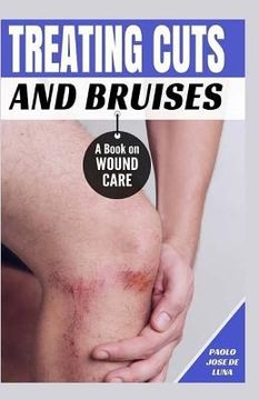 portada Treating Cuts and Bruises: A Book on Wound Care