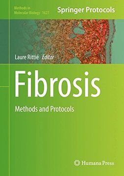 portada Fibrosis: Methods and Protocols (Methods in Molecular Biology)