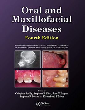 portada Oral and Maxillofacial Diseases, Fourth Edition (en Inglés)