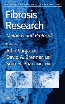 portada fibrosis research: methods and protocols (en Inglés)