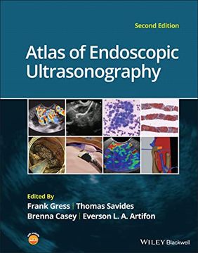 portada Atlas of Endoscopic Ultrasonography (in English)