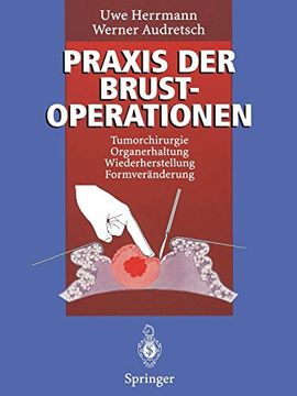 portada Praxis der Brustoperationen: Tumorchirurgie ― Organerhaltung ― Wiederherstellung ― Formveränderung (in German)