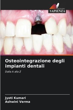 portada Osteointegrazione degli impianti dentali (en Italiano)