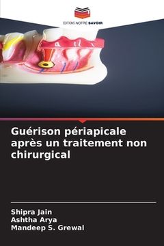 portada Guérison périapicale après un traitement non chirurgical (en Francés)