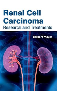 portada Renal Cell Carcinoma: Research and Treatments