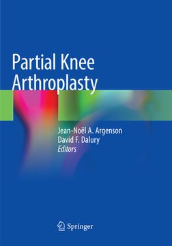 portada Partial Knee Arthroplasty (in English)