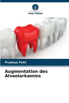 portada Augmentation des Alveolarkamms (en Alemán)