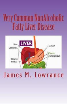 portada Very Common NonAlcoholic Fatty Liver Disease: How To Know if You Have Hepatic Steatosis (en Inglés)