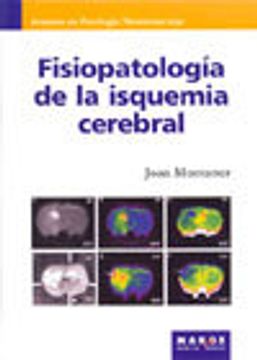 portada Fisiopatología de la isquemia cerebral (Avances en patología neurovascular)