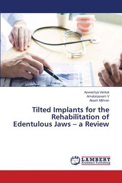 portada Tilted Implants for the Rehabilitation of Edentulous Jaws - a Review (in English)