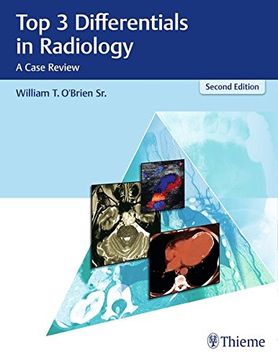 portada Top 3 Differentials in Radiology: A Case Review (en Inglés)