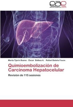 portada Quimioembolización de Carcinoma Hepatocelular: Revisión de 115 sesiones