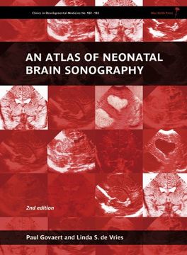 portada An Atlas of Neonatal Brain Sonography (en Inglés)