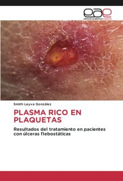 portada Plasma Rico en Plaquetas: Resultados del Tratamiento en Pacientes con Úlceras Flebostáticas (in Spanish)