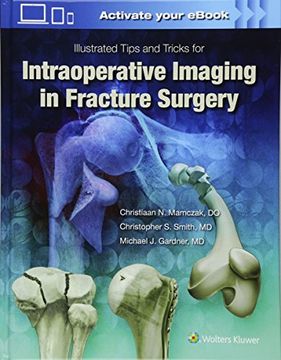 portada Illustrated Tips and Tricks for Intraoperative Imaging in Fracture Surgery (en Inglés)