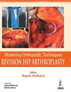 portada Mastering Orthopedic Techniques: Revision Hip Arthroplasty
