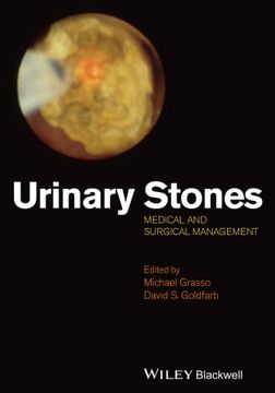 portada Urinary Stones: Medical and Surgical Management