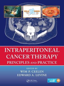 portada Intraperitoneal Cancer Therapy: Principles and Practice (en Inglés)