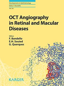 portada Oct Angiography in Retinal and Macular Diseases (Developments in Ophthalmology, Vol. 56) (en Inglés)