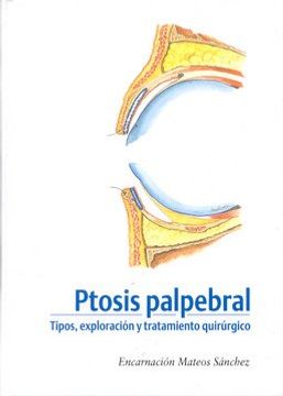 portada Ptosis Palpebral (in Spanish)