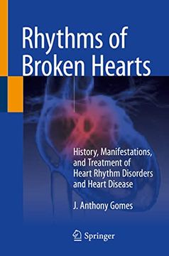 portada Rhythms of Broken Hearts: History, Manifestations, and Treatment of Heart Rhythm Disorders and Heart Disease (in English)