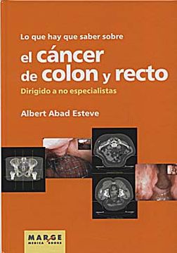 portada Lo que hay que Saber Sobre el Cáncer de Colon y Recto: Dirigido a no Especialistas (in Spanish)