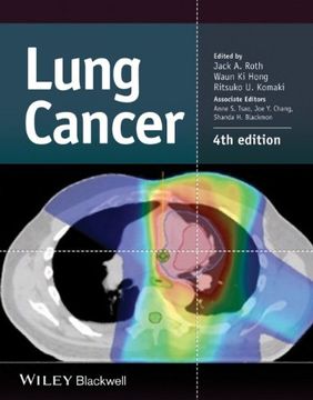 portada Lung Cancer (en Inglés)