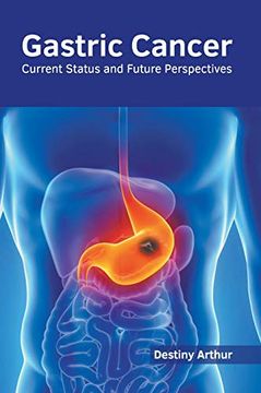portada Gastric Cancer: Current Status and Future Perspectives (en Inglés)